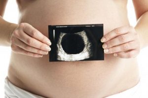 Kehamilan Kosong Bisa Dihindari dengan 6 Tips Ini